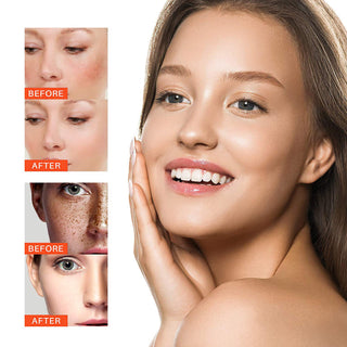 Melasma & Dark Spot Whitening Cream