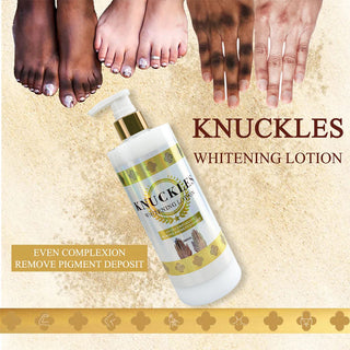 Dark Spot Removal Cream for Black Skin