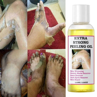 Yellow Orange Peeling Oil for Dark Knee Joints