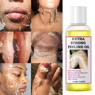 Extra Strong Skin Whitening Oil