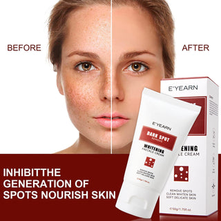 Melasma & Dark Spot Whitening Cream